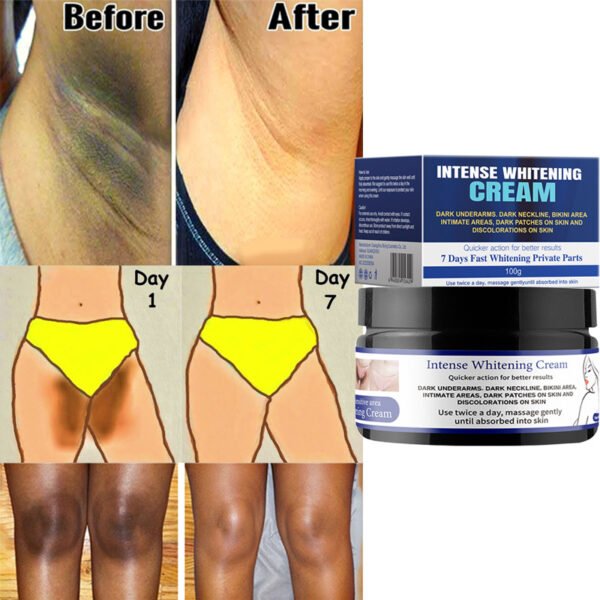 MOOYAM Snow White Private Cream Whitening and Rejuvenating Underarms and Inner Thighs Brightening and Anti-Darkness Cream Factory Wholesale Private Label OEM