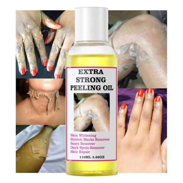 MOOYAM Peeling Oil Exfoliating Oil Elbows Knees Fingers Black Yellow Skin Oil Factory Wholesale Private Label OEM