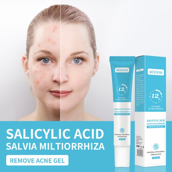 MOOYAM Salicylic Acid Anti-Acne Cream Lightens Acne Scars, Removes Blackheads, Closes Pores, Shrinks Pores, Plant Essence Anti-Acne Gel Manufacturer Wholesale Private Label OEM - Image 4