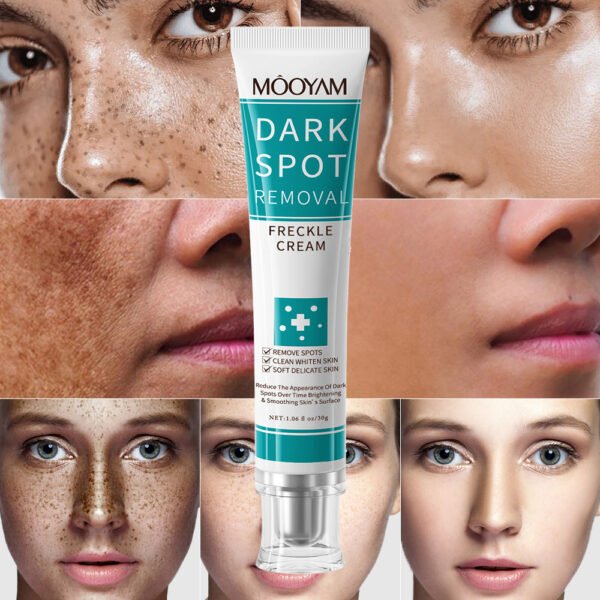 MOOYAM DARK SPOT REMOVAL CREAM WHITENING F RECKLE CREAM Factory Wholesale OEM Private Label