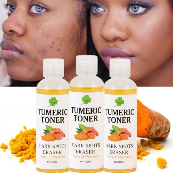 Dark Spots Eraser Turmeric Toner Wholesale Manufacturer OEM Private Label - Image 2