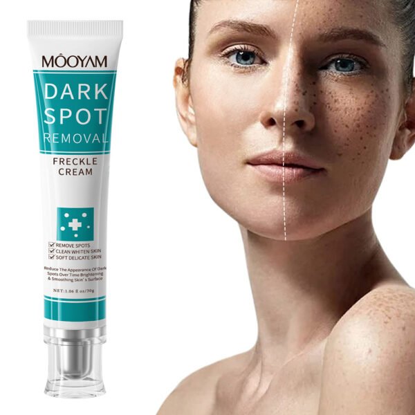 MOOYAM DARK SPOT REMOVAL CREAM WHITENING F RECKLE CREAM Factory Wholesale OEM Private Label - Image 3