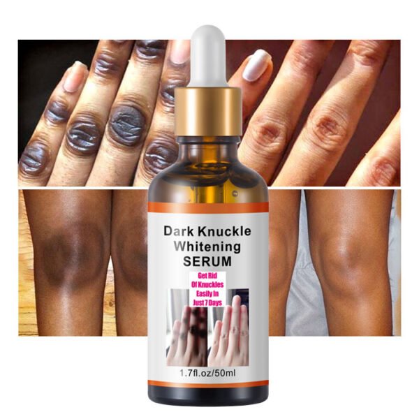 MOOYAM Dark Knuckles Whitening Serum Factory Wholesale OEM Private Label