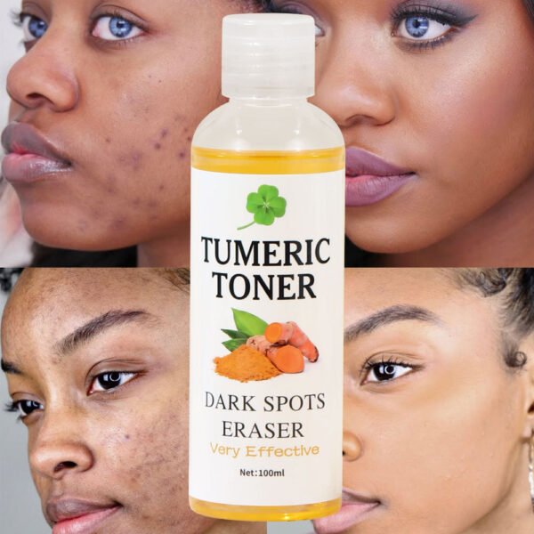 Dark Spots Eraser Turmeric Toner Wholesale Manufacturer OEM Private Label