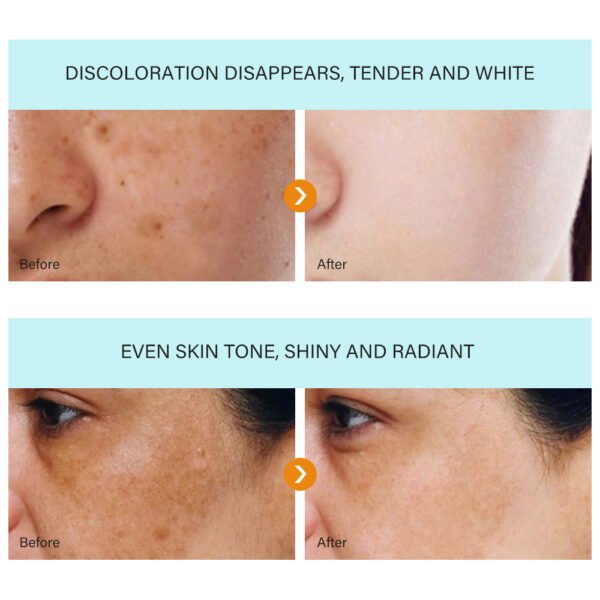 MOOYAM DARK SPOT REMOVAL CREAM WHITENING F RECKLE CREAM Factory Wholesale OEM Private Label - Image 4